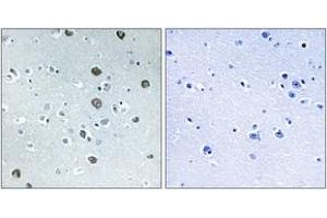 Immunohistochemistry analysis of paraffin-embedded human brain tissue, using MARCH2 Antibody. (MARCH2 antibody  (AA 191-240))