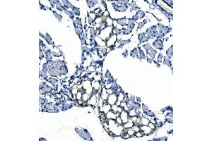 IHC analysis of eRF1/ETF1 using anti-eRF1/ETF1 antibody (ABIN7602626). (ETF1 antibody  (AA 9-342))