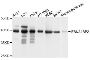 Western blot analysis of extracts of various cell lines, using EBNA1BP2 antibody. (EBNA1BP2 antibody  (AA 1-306))