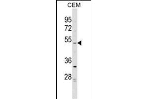 EVI2B Antibody (Center) (ABIN1538239 and ABIN2849160) western blot analysis in CEM cell line lysates (35 μg/lane). (EVI2B antibody  (AA 283-313))