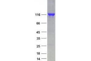 Western Blotting (WB) image for Retinol Binding Protein 3, Interstitial (RBP3) protein (Myc-DYKDDDDK Tag) (ABIN2730761)