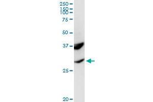Western Blotting (WB) image for anti-Proopiomelanocortin (POMC) (AA 1-267) antibody (ABIN519039)