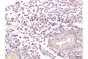 Formalin-fixed and human endometrium tissue labeled with Anti-NCF1/p47 phox Polyclonal Antibody, Unconjugated (ABIN750643) at 1:100 followed by conjugation to the secondary antibody and DAB staining (NCF1 antibody  (AA 151-250))
