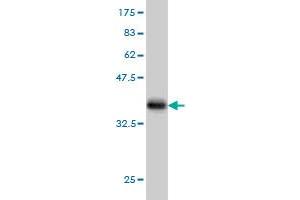 Western Blot detection against Immunogen (35. (AKT3 antibody  (AA 100-189))