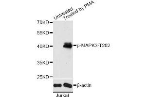 Western blot analysis of extracts of Jurkat cells, using Phospho-MAPK3-T202 antibody (ABIN2987683) at 1/2000 dilution. (ERK1 antibody  (pThr202))