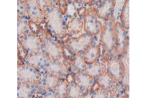 Immunohistochemistry (IHC) image for anti-Membrane Protein, Palmitoylated 6 (MAGUK P55 Subfamily Member 6) (MPP6) (AA 34-235) antibody (ABIN5013923)