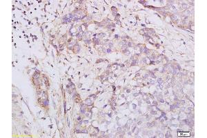 Immunohistochemistry (IHC) image for anti-Protein Kinase, CAMP-Dependent, Regulatory, Type II, alpha (PRKAR2A) (pSer96) antibody (ABIN752668)