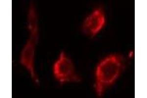 ABIN6275545 staining HeLa cells by IF/ICC. (PPP2R2B antibody  (Internal Region))