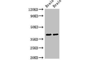 Western Blot Positive WB detected in: Rat brain tissue, Mouse brain tissue All lanes: STOML3 antibody at 3.