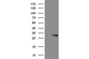 Image no. 2 for anti-Prefoldin Subunit 3 (PFDN3) antibody (ABIN1501700) (VBP1 antibody)