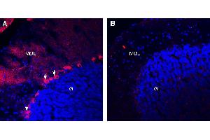 Expression of TrkB in mouse cerebellumImmunohistochemical staining of perfusion-fixed frozen mouse brain sections with Guinea Pig Anti-TrkB (extracellular) Antibody (ABIN7581928), (1:300), followed by goat anti-guinea pig-Alexa Fluor-594.