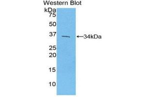 Western Blotting (WB) image for anti-Interferon Regulatory Factor 4 (IRF4) (AA 175-433) antibody (ABIN1859474) (IRF4 antibody  (AA 175-433))