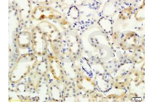 Formalin-fixed and paraffin embedded rat kidney labeled with Anti- NCX2/SLC8A2 Polyclonal Antibody, Unconjugated  at 1:200 followed by conjugation to the secondary antibody and DAB staining (SLC8A2 antibody  (AA 601-700))
