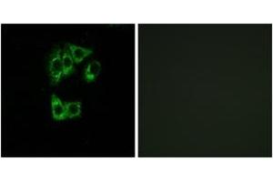 Immunofluorescence analysis of A549 cells, using GIMAP2 Antibody. (GIMAP2 antibody  (AA 201-250))