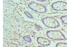 Immunohistochemistry of paraffin-embedded human colon tissue using ABIN7144372 at dilution of 1:100 (AP2M1 antibody  (AA 136-435))