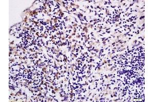 Formalin-fixed and paraffin embedded rat spleen labeled with Rabbit Anti-LPA2 Polyclonal Antibody, Unconjugated (ABIN2177376) at 1:200 followed by conjugation to the secondary antibody and DAB staining (EDG4 antibody  (AA 1-100))