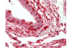 Human Lung, Respiratory Epithelium: Formalin-Fixed, Paraffin-Embedded (FFPE). (ADH7 antibody  (HRP))