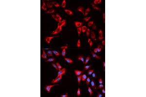 Immunofluorescence analysis of U2OS cells using EIF4B antibody. (EIF4B antibody)