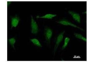 Immunostaining analysis in HeLa cells. (SOX12 antibody)