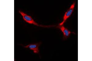 Immunofluorescent analysis of BMP8A staining in A549 cells. (BMP8A antibody  (C-Term))