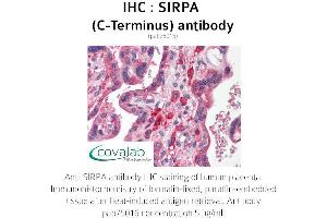 Image no. 2 for anti-Signal-Regulatory Protein alpha (SIRPA) antibody (ABIN1739274) (SIRPA antibody)