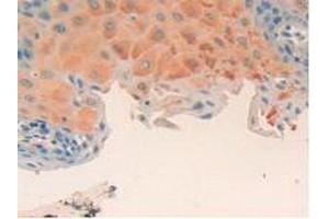 Figure. (Cyclin D2 antibody  (AA 68-278))