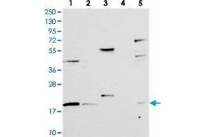 Western blot analysis of Lane 1: RT-4, Lane 2: U-251 MG, Lane 3: Human Plasma, Lane 4: Liver, Lane 5: Tonsil with RMI2 polyclonal antibody  at 1:250-1:500 dilution.