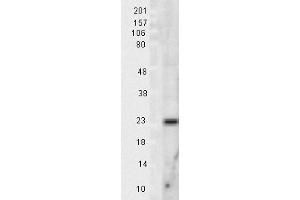 Mn SOD Rat tissue lysate 10ug Western Blotting 1 in 1000 copy.