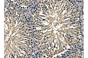 ABIN7095403 and ABIN7099460 at 1/100 staining rat testis tissue by IHC-P.