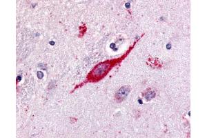 Anti-GPR85 antibody IHC of human brain, neuron. (GPR85 antibody  (C-Term))