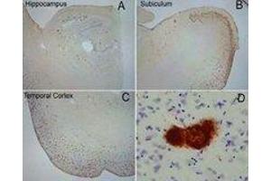 Labeling of amyloid fibrils was observed in the hippocampus (A), subiculum (B) and frontal cortex (C) in Alzheimer disease. (Amyloid Fibrils antibody)