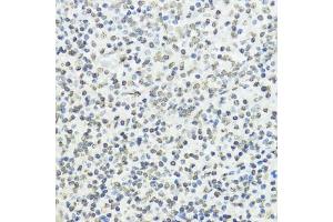 Immunohistochemistry of paraffin-embedded human tonsil using Phospho-Histone H3-T45 antibody (ABIN7267692) at dilution of 1:100 (40x lens). (Histone 3 antibody  (H3T45p))