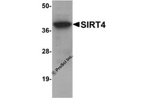 Western Blotting (WB) image for anti-Sirtuin 4 (SIRT4) (N-Term) antibody (ABIN1031569) (SIRT4 antibody  (N-Term))