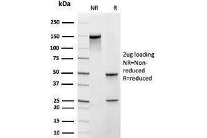 SDS-PAGE Analysis Purified Frataxin Recombinant Mouse Monoclonal Antibody (rFXN/2124). (Recombinant Frataxin antibody  (AA 57-210))