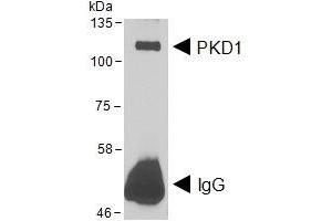HEK293 lysate overexpressing Human DYKDDDDK-tagged PKD1 was used to immunoprecipitate PKD1 with 2ug ABIN4902744. (PKC mu antibody)