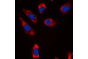 Immunofluorescent analysis of STMN1 staining in HeLa cells.