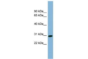 WB Suggested Anti-CENPQ Antibody Titration: 0. (CENPQ antibody  (N-Term))
