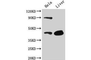 Western Blot Positive WB detected in: Hela whole cell lysate, Mouse liver tissue All lanes: CD46 antibody at 3 μg/mL Secondary Goat polyclonal to rabbit IgG at 1/50000 dilution Predicted band size: 44, 45, 43, 41, 42, 40, 37 kDa Observed band size: 44 kDa (CD46 antibody  (AA 164-325))