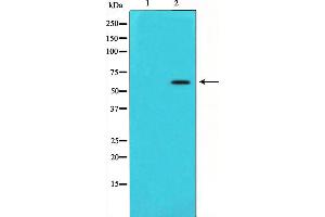 Western blot analysis of Angiopoietin 1 expression in HeLa cells,The lane on the left is treated with the antigen-specific peptide. (Angiopoietin 1 antibody  (Internal Region))