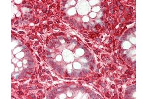 Human Colon: Formalin-Fixed, Paraffin-Embedded (FFPE). (ST3GAL4 antibody  (AA 171-220))