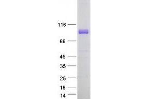 Validation with Western Blot (MEG3 Protein (Transcript Variant 1) (Myc-DYKDDDDK Tag))