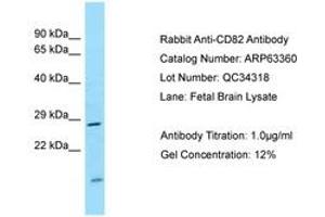 Image no. 1 for anti-CD82 (CD82) (AA 98-147) antibody (ABIN6749974) (CD82 antibody  (AA 98-147))