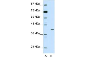 WB Suggested Anti-HMBOX1 Antibody Titration:  2. (HMBOX1 antibody  (N-Term))