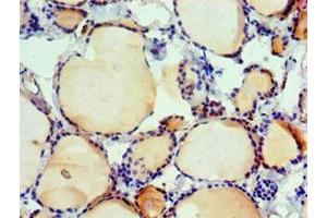 Immunohistochemistry of paraffin-embedded human thyroid tissue using ABIN7156617 at dilution of 1:100 (IRF2 antibody  (AA 120-349))
