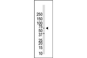 Western blot analysis of anti-BR1B Pab ap2005a in NCI- cell lysate. (BMPR1B antibody  (N-Term))