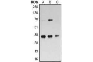 Western blot analysis of RPL5 expression in Hela (A), Jurkat (B), MOLT4 (C) whole cell lysates.