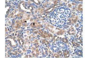 GALNT6 antibody was used for immunohistochemistry at a concentration of 4-8 ug/ml to stain Epithelial cells of renal tubule (arrows) in Human Kidney. (GALNT6 antibody  (N-Term))