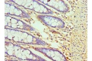 Immunohistochemistry of paraffin-embedded human colon tissue using ABIN7148781 at dilution of 1:100 (CXXC1 antibody  (AA 1-210))