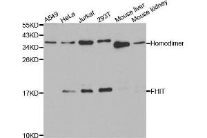 Western blot analysis of extracts of various cell lines, using FHIT antibody. (FHIT antibody  (AA 25-147))