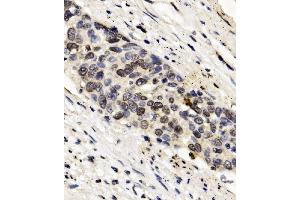IHC analysis of FOXF1 using anti-FOXF1 antibody (ABIN7601744).